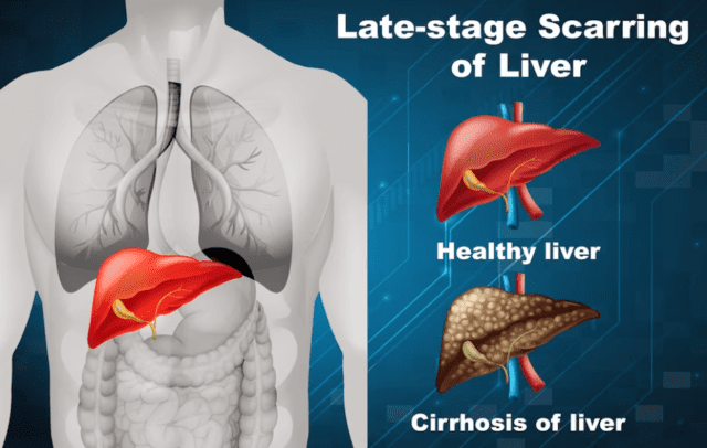 List of Liver Diseases and Syndromes - QPIOR